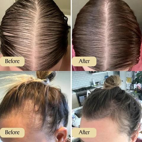 Vegan Natural Hair Growth Oil
